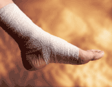 AnkleSprain