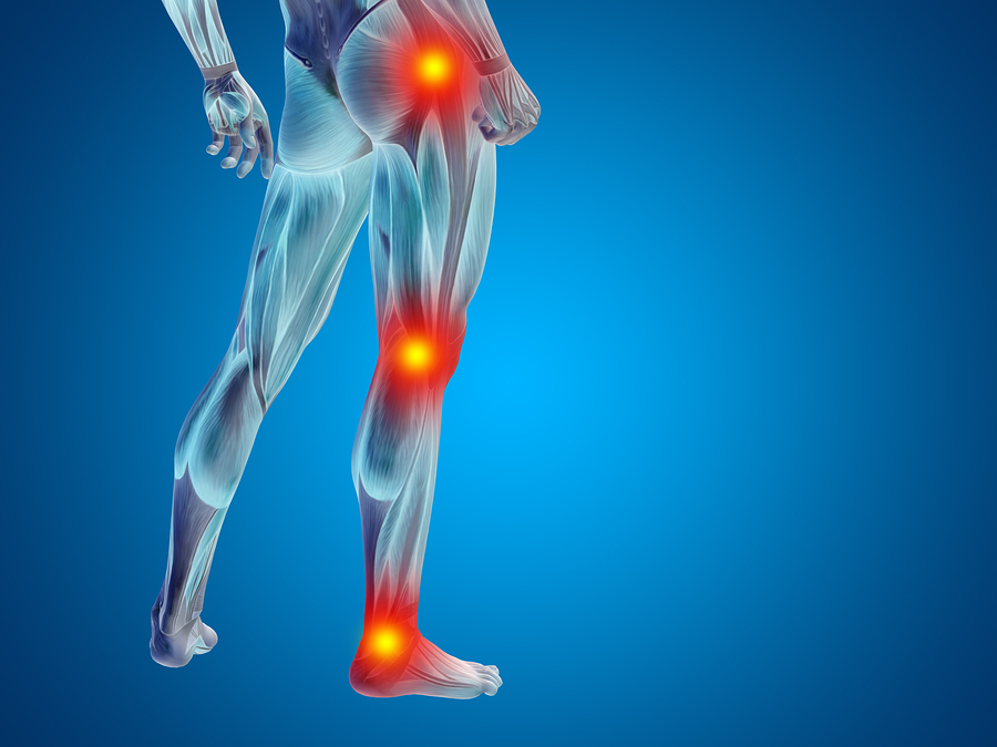 LEG PAIN - Glasgow Spine & Wellness, chiropractor in ...