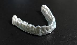 aligner on model