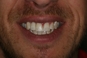 smile before 7